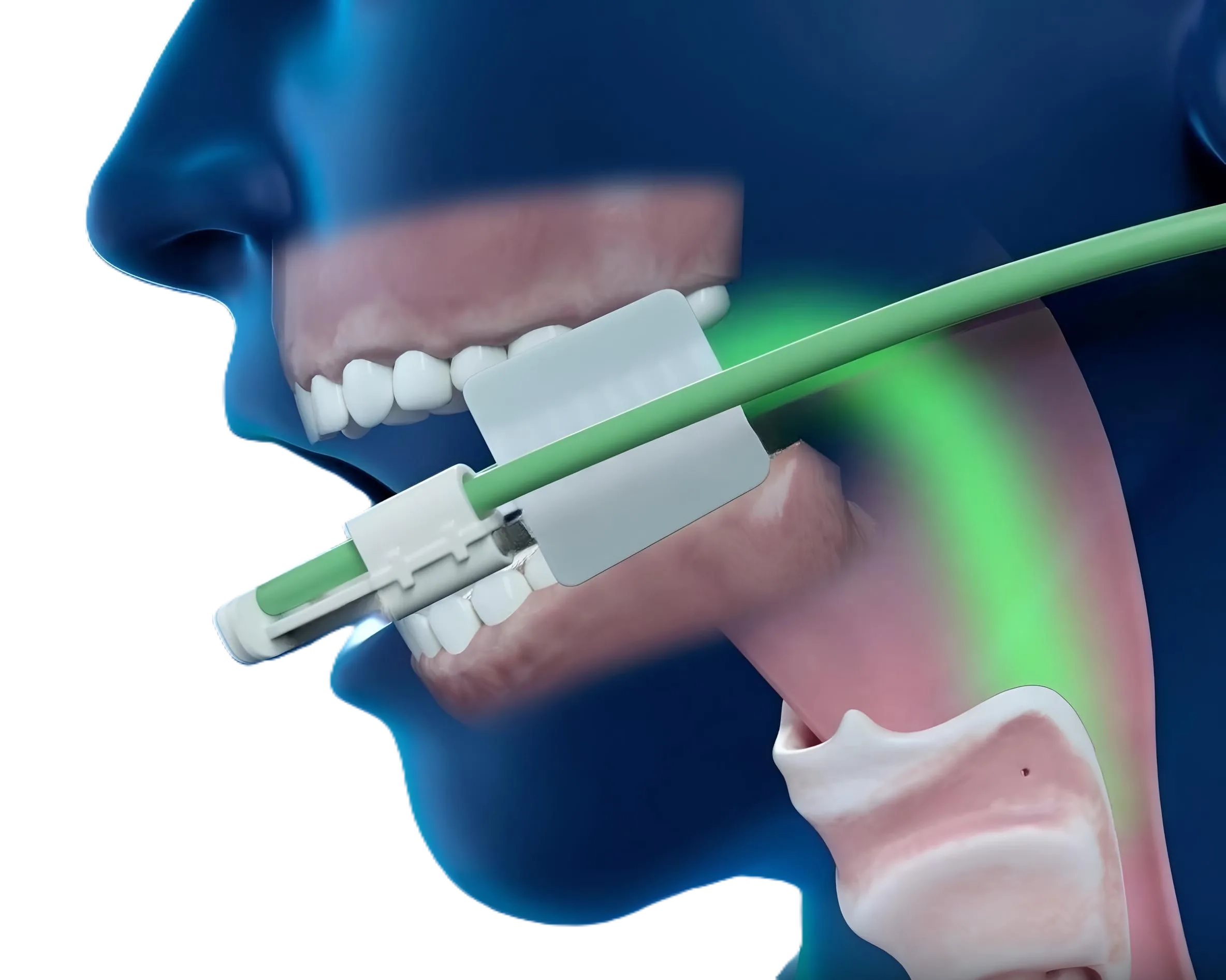 AIM showing flow of oxygen into the oropharynx